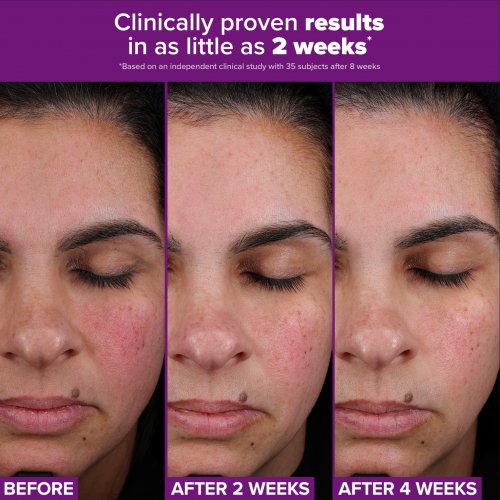 PRO Retinaldehyde Treatment 