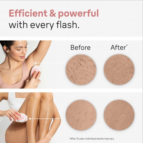 Braun IPL Silk Expert Mini 1014