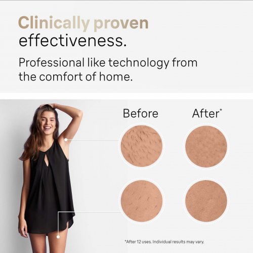 Braun IPL Silk-expert Pro 5 PL5137