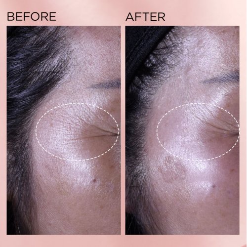 Retinol + HPR Ceramide Capsules Rapid Skin-Renewing Serum 