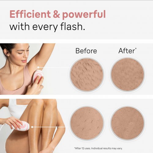 Braun IPL Silk Expert Mini 1014